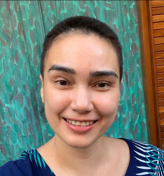 Hingga pada Senin (20/7/2020), istri dari Franky Sihombing ini mengunggah foto rambutnya yang bondol hingga nyaris botak. Foto: Instagram/@febyfebiola_