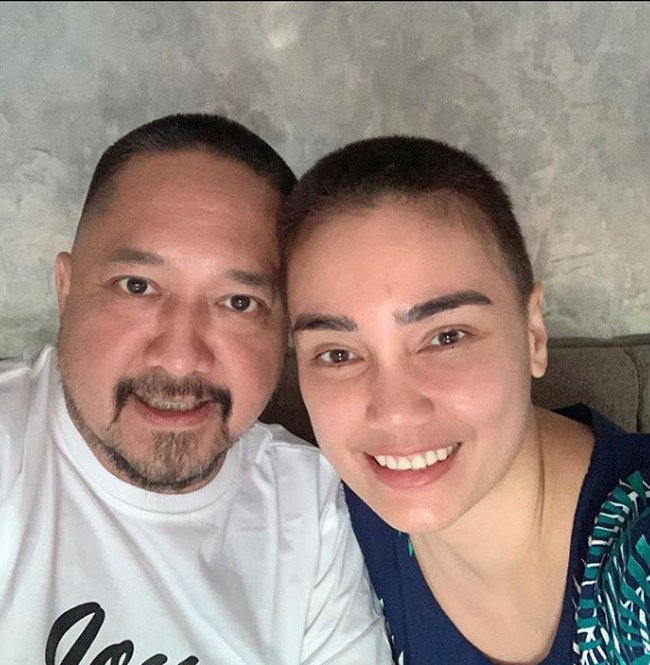 Feby menjelaskan bahwa dia harus menjalani sesi kemoterapi sebanyak enam kali setelah operasi kista ovarium. Foto: Instagram/@febyfebiola_