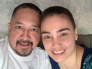 Franky Sihombing Ikutan Botak Biar Kompak dengan Feby Febiola