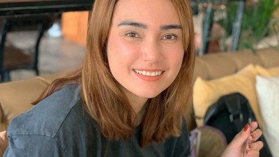 10 Transformasi Feby Febiola yang Kini Berambut Bondol Setelah Kemoterapi