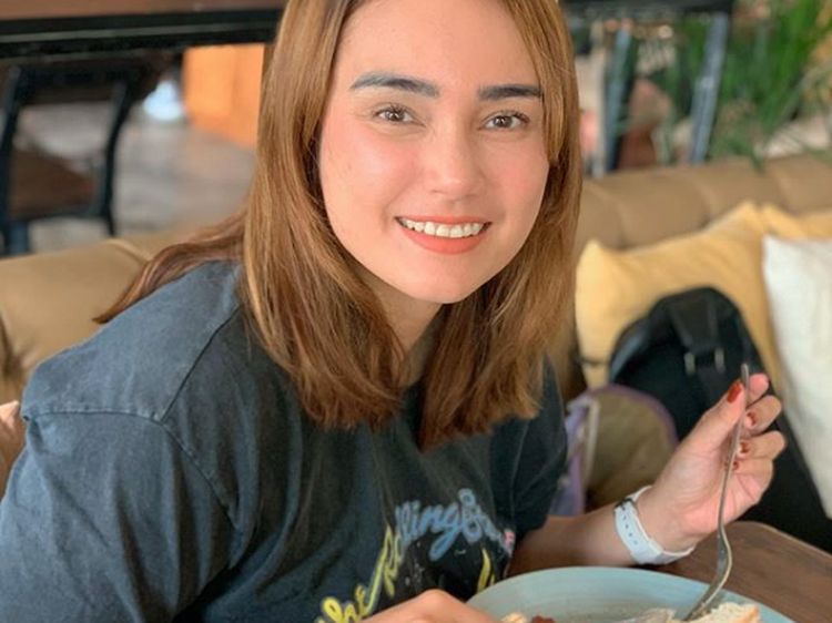 10 Transformasi Feby Febiola yang Kini Berambut Bondol Setelah Kemoterapi