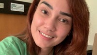 Feby kehilangan rambut panjangnya itu setelah menjalani proses kemoterapi. Dok. instagram/febyfebiola_