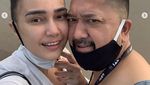 Feby Febiola Idap Kanker, Rambut Panjang Jadi Bondol Tapi Tetap Senyum