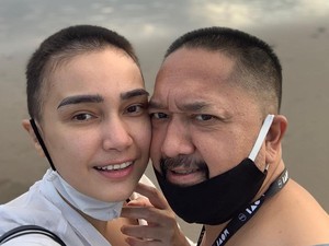 Mengharukan, Suami Feby Febiola Ikut Gunduli Rambut