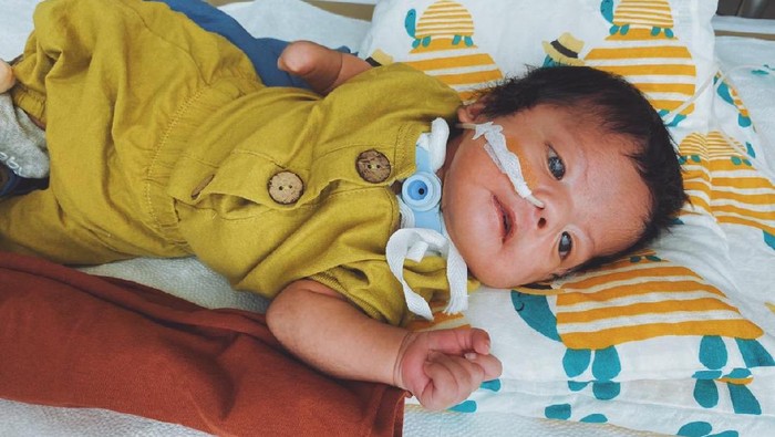 Bayi Hiro Bayi Hiro idap kondisi langka