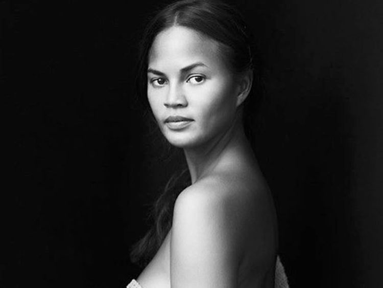 Chrissy Teigen Ingin Operasi Kecilkan Payudaranya, Ada Apa?
