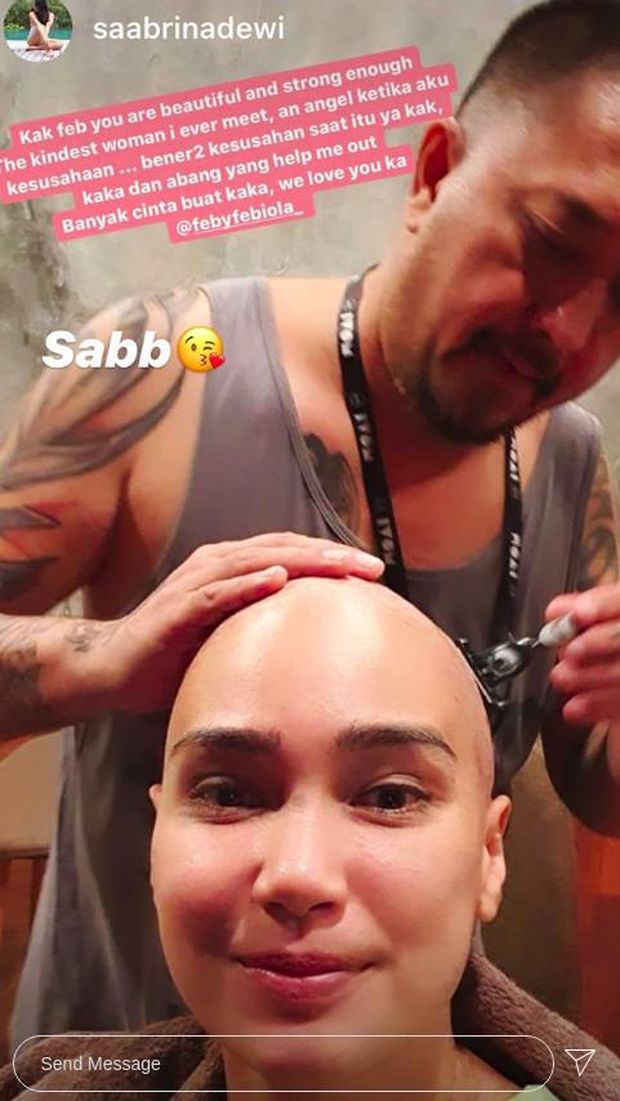 feby febiola botakin rambutnya