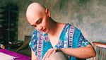 Potret Feby Febiola Cantik dengan Kepala Plontos