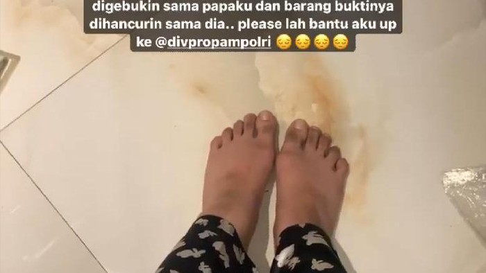 Tangkapan Layar Postingan Aurellia Renatha soal Penganiayaan yang Dialaminya