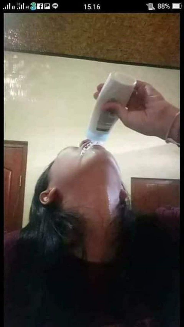 -