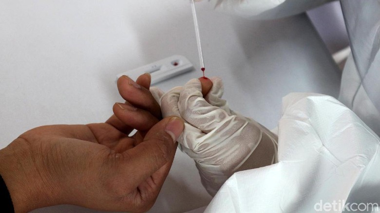 Pengumuman! Rapid Test Rp 85 Ribu Tersedia di Stasiun Senen Lho Layanan rapid test dengan biaya Rp 85 ribu mulai hari ini telah tersedia di sejumlah stasiun Indonesia. Salah satunya Stasiun Pasar Senen, Jakarta.
