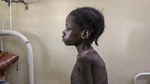 Corona Bikin Anak-anak di Burkina Faso Makin Menderita