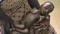 Haboue Solange Boue yang berusia satu bulan, menunggu perawatan medis di sebuah rumah sakit di Kota Hounde, Provinsi Tuy, Burkina Faso pada Kamis 11 Juni 2020 lalu.
