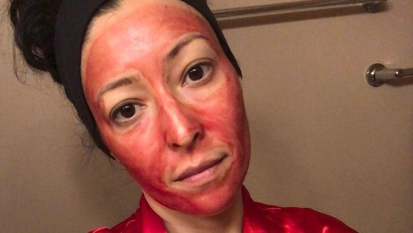Potret Wanita Gunakan Darah Menstruasi Sebagai Masker, Ngaku Bikin Glowing