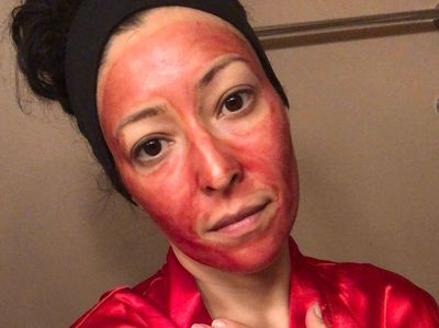 Potret Wanita Gunakan Darah Menstruasi Sebagai Masker, Ngaku Bikin Glowing