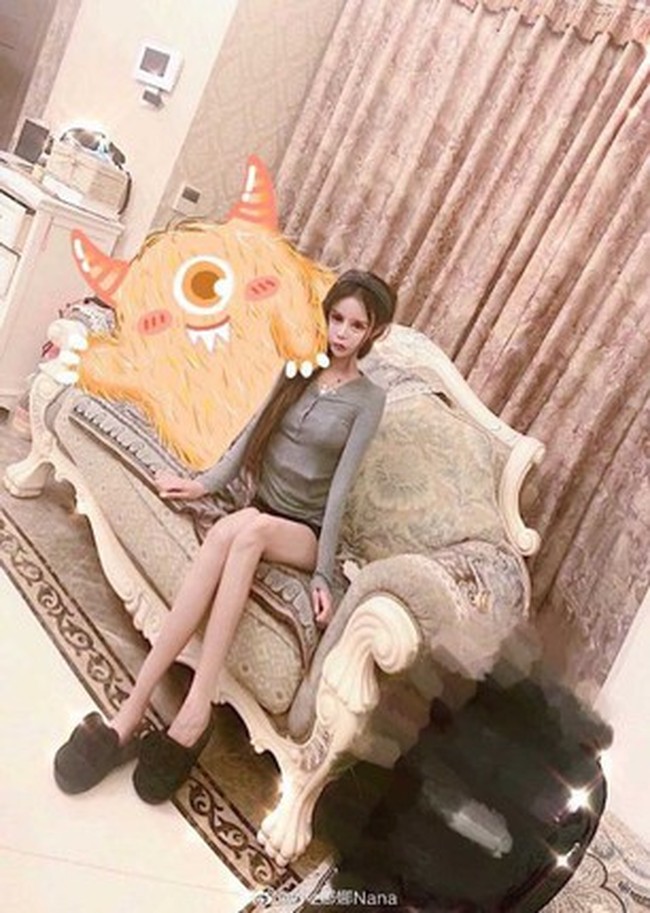 Saking kecanduannya operasi plastik, Nana sampai mengorbankan pendidikannya. Nana mengatakan dia sampai tidak punya waktu untuk sekolah karena biasanya setelah operasi plastik harus istirahat di rumah hingga kondisinya pulih. Foto: Dok. Weibo Little Z Nana
