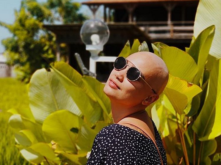 Potret Feby Febiola Cantik dengan Kepala Plontos