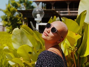 Feby Febiola Jalani Kemoterapi Terakhir Hari Ini