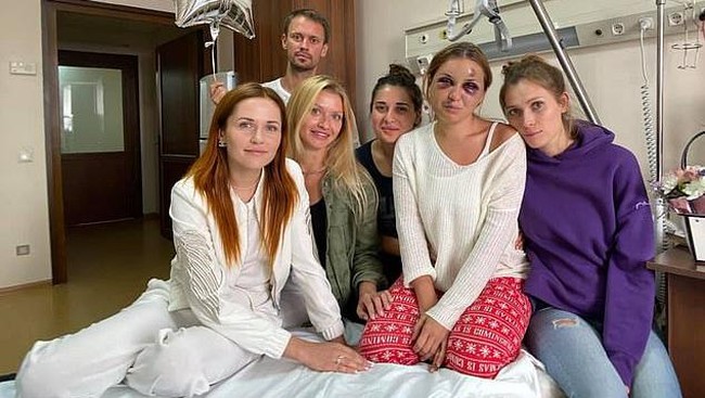 Anastasia kini dirawat di rumah sakit karena memar parah pada wajah dan kepalanya.  Foto: dok. Facebook