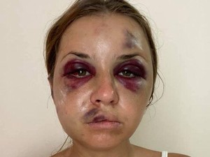 Cerita Pilu Presenter Cantik, Hampir Diperkosa & Dipukuli Sampai Babak Belur