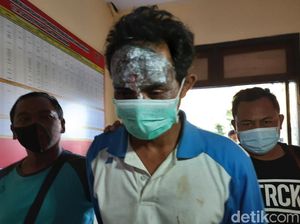 Aksi Dukun Cabul Masukkan Telur ke Kemaluan Lukai Wajah Sendiri Sebelum Ditangkap