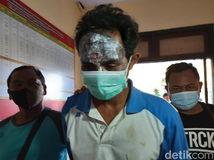 Lukai Wajah Sendiri Dukun Cabul Masukkan Telur Ke Kemaluan Dibawa Ke Rs