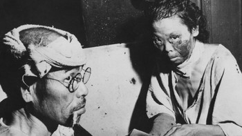 Selama dua sampai empat bulan berikutnya, efek dari bom atom menewaskan antara 90.000 dan 146.000 orang di Hiroshima dan 60.000 dan 80.000 orang di Nagasaki, kira-kira setengahnya terjadi di hari pertama. Berbulan-bulan sesudahnya, banyak orang meninggal karena luka bakar, penyakit radiasi, diperparah dengan penyakit lain dan malnutrisi. Meski Hiroshima memiliki garnisun militer cukup besar, sebagian besar yang tewas adalah warga sipil. Foto: Getty Images