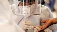 Prosedur rapid test dimulai dengan mengambil sampel darah dari ujung jari kemudian diteteskan ke alat rapid test.