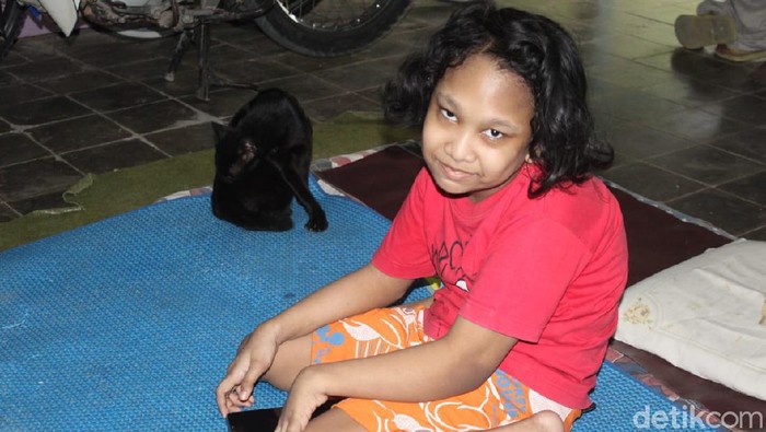 Vea (11), bocah disabilitas yang sampaikan pesan ingin sekolah kepada Gubernur Jateng Ganjar Pranowo, Sabtu (8/8/2020).