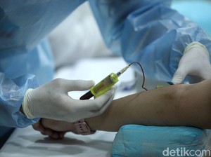 Ikut-ikutan Tes Antibodi Setelah Vaksin Corona, Memangnya Tahu Standarnya?