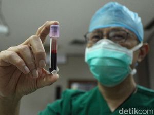 Sempat Terinfeksi COVID-19 Awal 2020? Waspada Kemungkinan Terinfeksi Lagi