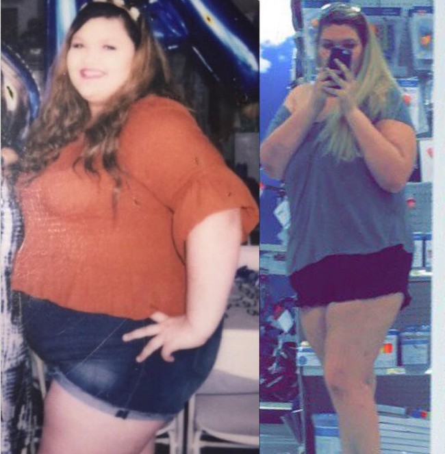 Setelah prosedur tersebut, Tannen pun tetap butuh melakukan diet dan olahraga ketat. Hasilnya pun memuaskan, berat badan Tannen lebih mudah untuk turun.  Foto: Instagram