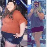 Setelah prosedur tersebut, Tannen pun tetap butuh melakukan diet dan olahraga ketat. Hasilnya pun memuaskan, berat badan Tannen lebih mudah untuk turun.  Foto: Instagram