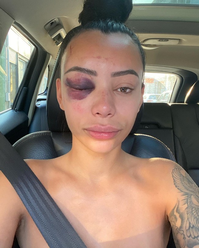 Awalnya, dia tidak ingin menceritakan kejadian ini, namun ia berpikir kembali bahwa tindakan kekerasan seperti ini perlu disebar luaskan agar tidak ada korban lainnya.  Foto: dok. Instagram