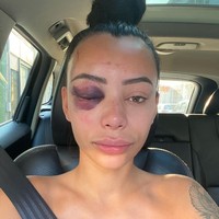 Awalnya, dia tidak ingin menceritakan kejadian ini, namun ia berpikir kembali bahwa tindakan kekerasan seperti ini perlu disebar luaskan agar tidak ada korban lainnya.  Foto: dok. Instagram