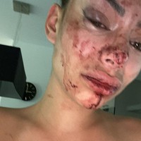 Bintang reality show asal Belgia itu baru saja mengalami tindakan aniaya oleh salah seorang temannya. Dia dipukuli oleh pria tersebut saat mengadakan pesta di rumahnya.  Foto: Instagram