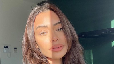 Foto: Penampakan Wajah Babak Belur Bintang Reality Show Cantik yang Dianiaya