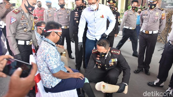 Toton Hartono penyandang difabel dapat bantuan kaki palsu.