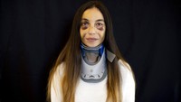 Angelique Sabounjian, terluka di kantornya ketika ledakan di Beirut yang seperti bom atom itu mengguncang Lebanon.  