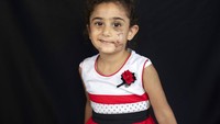 Yara Saeid (4), yang terluka di apartemen orangtuanya saat ledakan besar yang terasa hingga ke Siprus itu terjadi.  