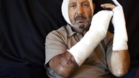 Rainier Jreissati (63), seorang pengusaha, yang terluka di rumahnya saat terjadi ledakan besar di Beirut, Lebanon.  