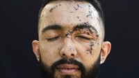 Hussein Haidar (27), sedang berada di kantornya saat ledakan besar akibat 2.750 ton amonium nitrat terbakar di Pelabuhan Beirut, Lebanon.  