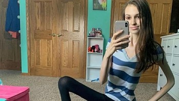 Mungkin terinspirasi Luffy di serial anime dan manga One Piece. Foto: Bored Panda