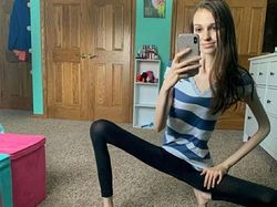 Foto Editan Konyol Demi Eksis di Medsos