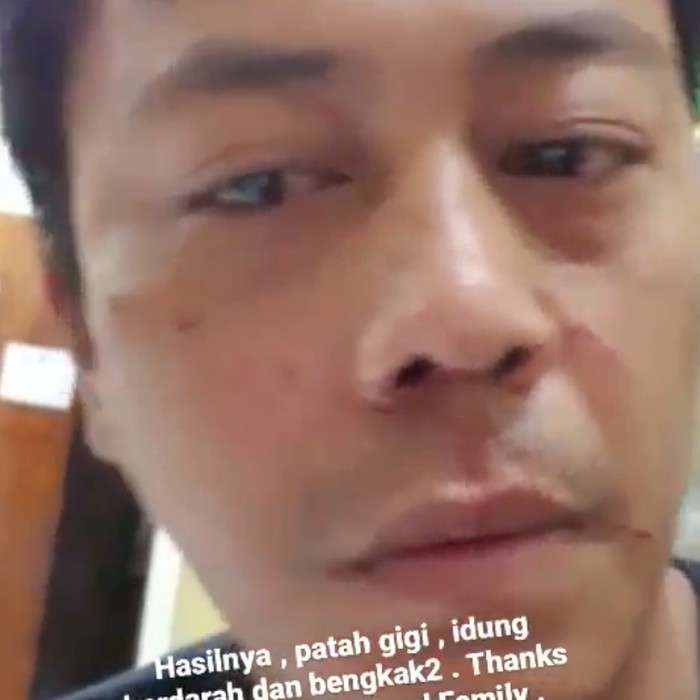 Gio Idol