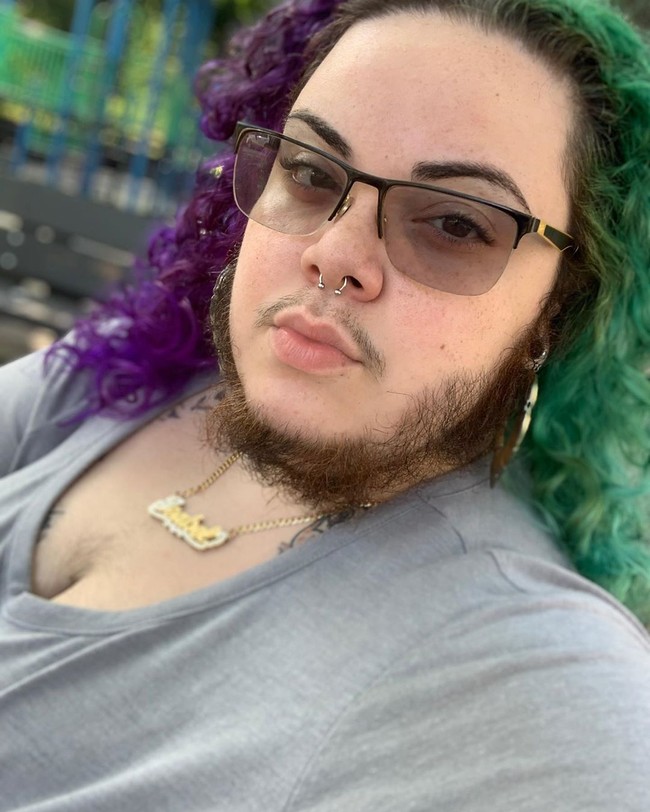 Gangguan hormon tersebut yang membuat wajah Alma ditumbuhi jenggot. Bulu-bulu di wajahnya mulai tumbuh ketika usianya 15 tahun. Selama bertahun-tahun wanita 27 tahun itu mencukur jenggotnya karena terlalu malu dengan penampilannya yang seperti pria.  Foto: dok. Instagram