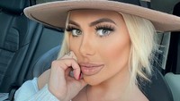 Ia pun tak ragu melakukan operasi plastik untuk terlihat menawan. Dok. Instagram/chloegshore1