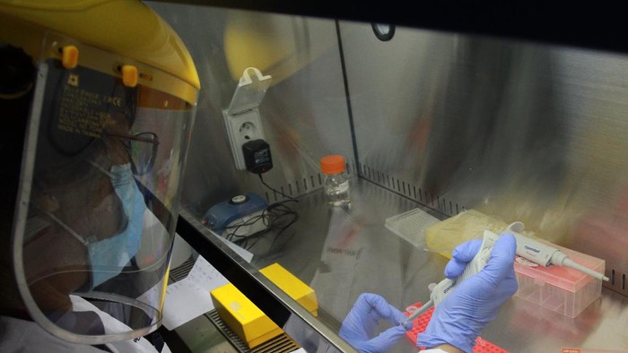 Doktor Tjandrawati Mozef Peneliti Biokimia Farmasi LIPI yang juga penemu menunjukan detection kit 