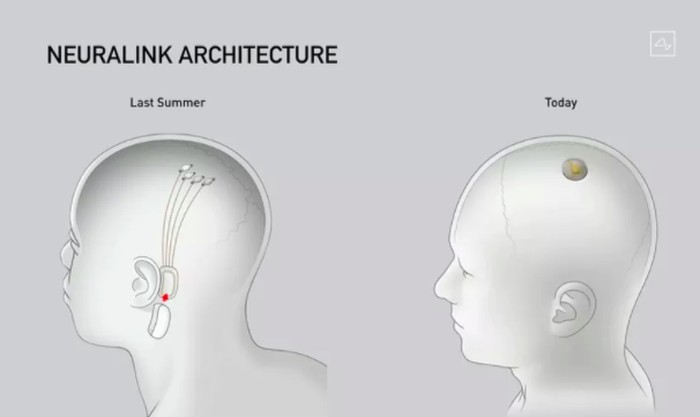 Neuralink