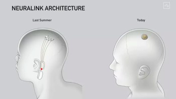 Elon Musk adalah salah satu pendiri dari Neuralink yang lahir pada tahun 2016. Tujuan perusahaan ini adalah menghubungkan otak manusia dengan komputer. Teknologinya diklaim memungkinkan orang lumpuh memesan belanja misalnya, berkomunikasi dengan teman, dan menjelajahi website secara langsung dengan memanfaatkan kekuatan gelombang otak. Foto: Neuralink